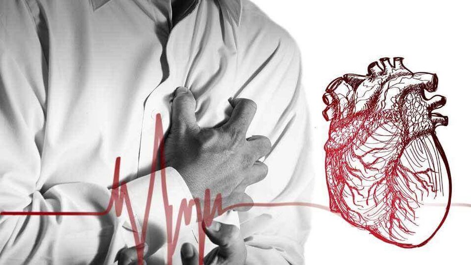 Extrasistola poate apărea din cauza aritmiei cardiace în osteocondroza toracică