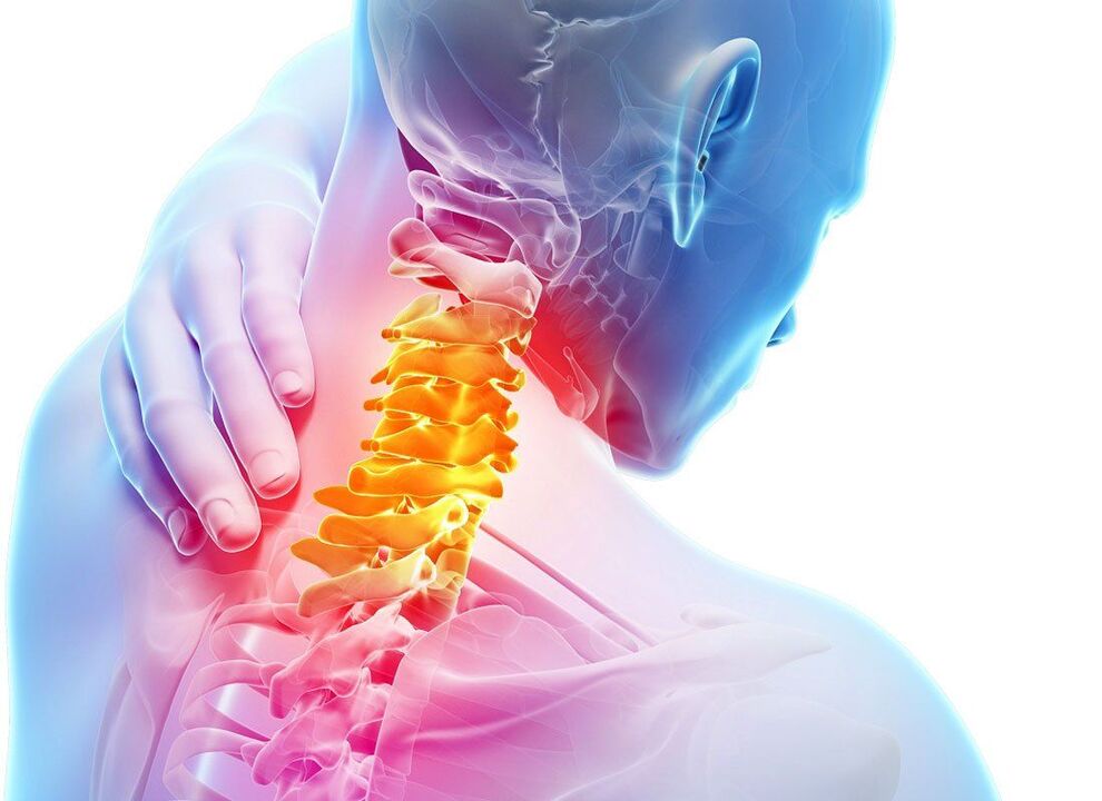 Simptomele osteocondrozei spinale