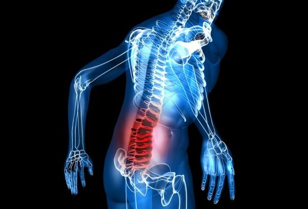 Simptome de osteochondroză