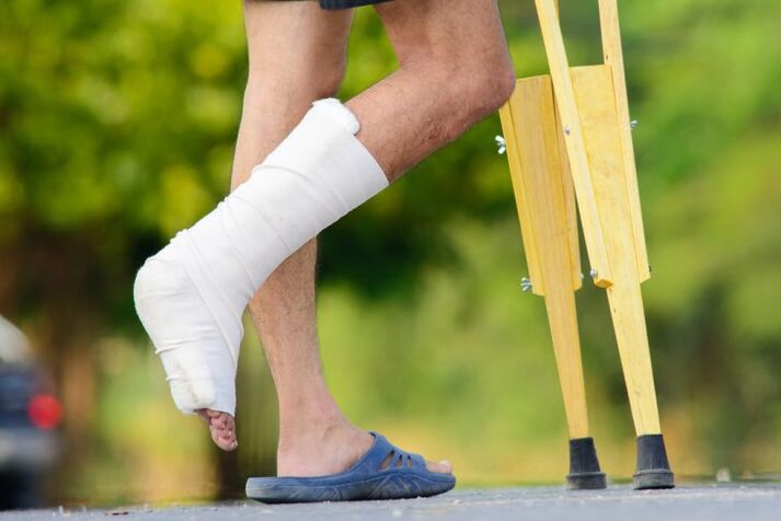 Leziunea gleznei ca cauză a osteoartritei