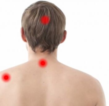 focare de osteocondroză