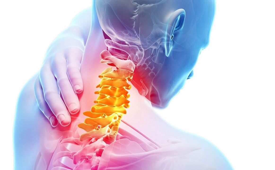 Durerea în osteocondroza cervicală